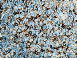 CD11a/Integrin alpha-L Mouse anti-Human, Clone: 1E3H12, Proteintech 150