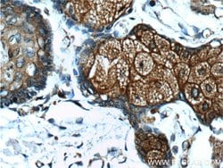 CD1d Mouse anti-Human, Clone: 1C12F1, Proteintech 150 &mu;L; Unconjugated:Antibodies,