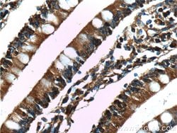 CD1d Mouse anti-Human, Clone: 1C12F1, Proteintech 150 &mu;L; Unconjugated:Antibodies,