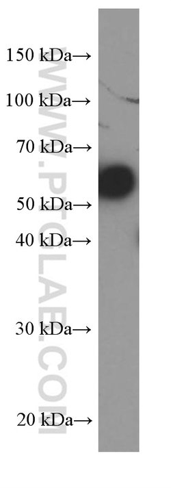 PAI-1 Mouse anti-Human, Porcine, Clone: 1H4A5, Proteintech:Antibodies:Primary