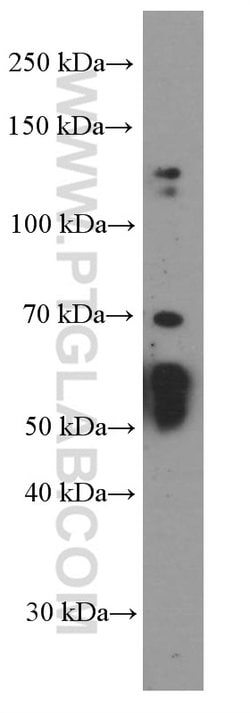 AIRE Mouse anti-Human, Porcine, Clone: 1A3C3, Proteintech:Antibodies:Primary