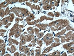 CLPP Mouse anti-Human, Porcine, Clone: 2E1D9, Proteintech 150 &mu;L; Unconjugated:Antibodies,