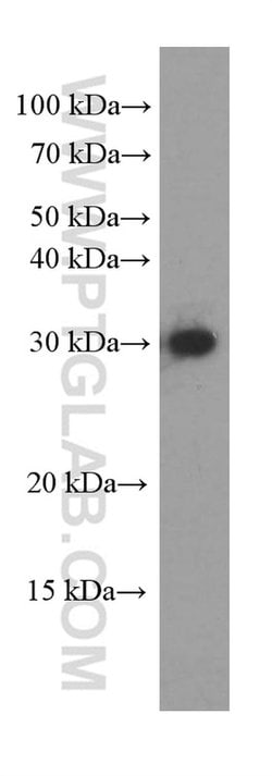 CLPP Mouse anti-Human, Porcine, Clone: 2E1D9, Proteintech 150 &mu;L; Unconjugated:Antibodies,
