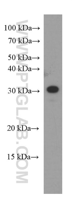 CLPP Mouse anti-Human, Porcine, Clone: 2E1D9, Proteintech 150 &mu;L; Unconjugated:Antibodies,
