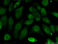 ERCC1 Mouse anti-Human, Clone: 1H4D5, Proteintech:Antibodies:Primary Antibodies