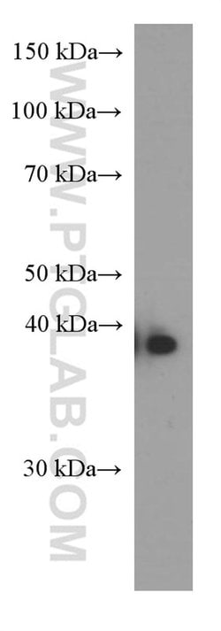 ERCC1 Mouse anti-Human, Clone: 1H4D5, Proteintech:Antibodies:Primary Antibodies