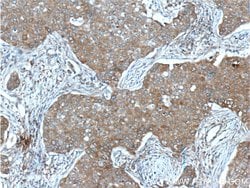IGF1R beta chain Mouse anti-Human, Rat, Clone: 3C6A11, Proteintech:Antibodies:Primary