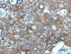 IGF1R beta chain Mouse anti-Human, Rat, Clone: 3C6A11, Proteintech:Antibodies:Primary