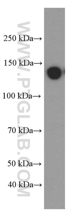 IGF1R beta chain Mouse anti-Human, Rat, Clone: 3C6A11, Proteintech:Antibodies:Primary