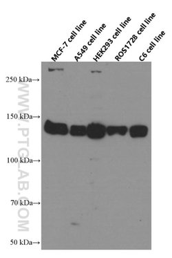 IGF1R beta chain Mouse anti-Human, Rat, Clone: 3C6A11, Proteintech:Antibodies:Primary