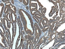 IGF1R beta chain Mouse anti-Human, Rat, Clone: 3C6A11, Proteintech:Antibodies:Primary
