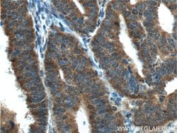 IGF1R beta chain Mouse anti-Human, Rat, Clone: 3C6A11, Proteintech:Antibodies:Primary