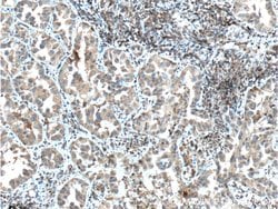 IGF1R beta chain Mouse anti-Human, Rat, Clone: 3C6A11, Proteintech:Antibodies:Primary
