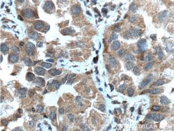 IGF1R beta chain Mouse anti-Human, Rat, Clone: 3C6A11, Proteintech:Antibodies:Primary