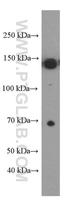 IGF1R beta chain Mouse anti-Human, Rat, Clone: 3C6A11, Proteintech:Antibodies:Primary