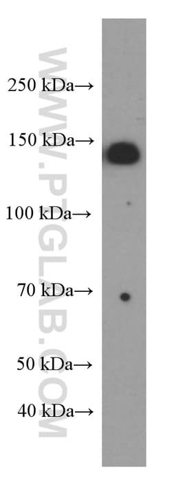 IGF1R beta chain Mouse anti-Human, Rat, Clone: 3C6A11, Proteintech:Antibodies:Primary