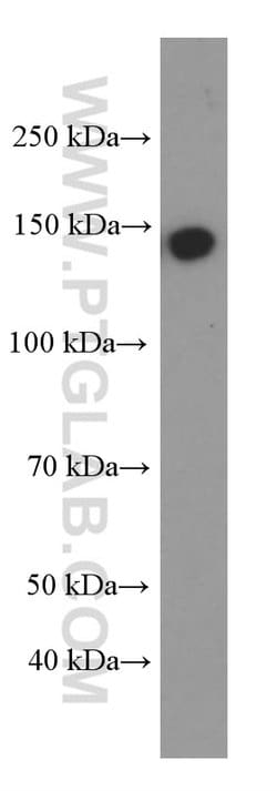 IGF1R beta chain Mouse anti-Human, Rat, Clone: 3C6A11, Proteintech:Antibodies:Primary