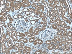 SDCCAG8 Mouse anti-Human, Clone: 2H1A4, Proteintech 150 &mu;L; Unconjugated:Antibodies,