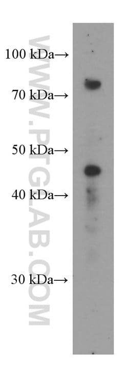 SDCCAG8 Mouse anti-Human, Clone: 2H1A4, Proteintech 150 &mu;L; Unconjugated:Antibodies,