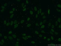 Pan Acetylation Mouse anti-Canine, Human, Mouse, Rat, Clone: 1D5F2, Proteintech 150 &mu;L | Buy Online | Proteintech Group Inc | Fisher Scientific