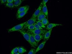 HSPA2 Mouse anti-Human, Mouse, Rat, Clone: 1A4A9, Proteintech 150 &mu;L;