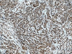 HSPA2 Mouse anti-Human, Mouse, Rat, Clone: 1A4A9, Proteintech 150 &mu;L;