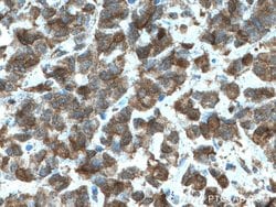 HSPA2 Mouse anti-Human, Mouse, Rat, Clone: 1A4A9, Proteintech 150 &mu;L;