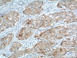 VCAM-1 Mouse anti-Human, Clone: 1B12F12, Proteintech 150 &mu;L; Unconjugated:Antibodies,