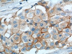 VCAM-1 Mouse anti-Human, Clone: 1B12F12, Proteintech 150 &mu;L; Unconjugated:Antibodies,