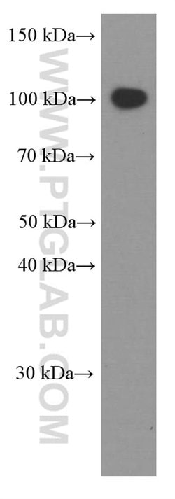 VCAM-1 Mouse anti-Human, Clone: 1B12F12, Proteintech 150 &mu;L; Unconjugated:Antibodies,