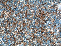 VCAM-1 Mouse anti-Human, Clone: 1B12F12, Proteintech 150 &mu;L; Unconjugated:Antibodies,