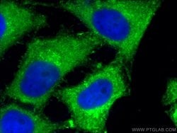Sestrin2 Mouse anti-Human, Porcine, Rat, Clone: 1A1A4, Proteintech:Antibodies:Primary