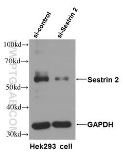 Sestrin2 Mouse anti-Human, Porcine, Rat, Clone: 1A1A4, Proteintech:Antibodies:Primary