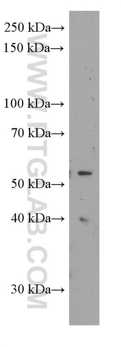 Sestrin2 Mouse anti-Human, Porcine, Rat, Clone: 1A1A4, Proteintech:Antibodies:Primary