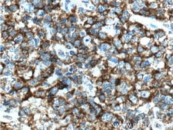 CD19 Mouse anti-Human, Clone: 1C10A1, Proteintech 150 &mu;L; Unconjugated:Antibodies,