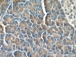 LIPH Mouse anti-Human, Porcine, Clone: 1F5D10, Proteintech 150 &mu;L; Unconjugated:Antibodies,