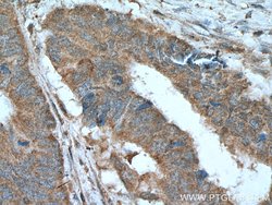LIPH Mouse anti-Human, Porcine, Clone: 1F5D10, Proteintech 150 &mu;L; Unconjugated:Antibodies,