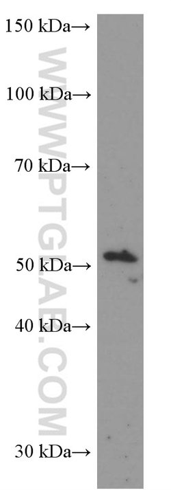 LIPH Mouse anti-Human, Porcine, Clone: 1F5D10, Proteintech 150 &mu;L; Unconjugated:Antibodies,