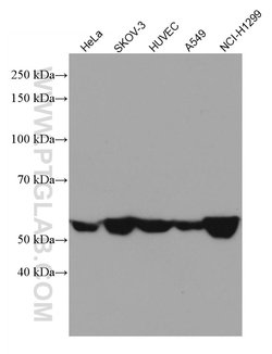 CD47 Mouse anti-Human, Clone: 1E1D8, Proteintech 150 &mu;L; Unconjugated:Antibodies,