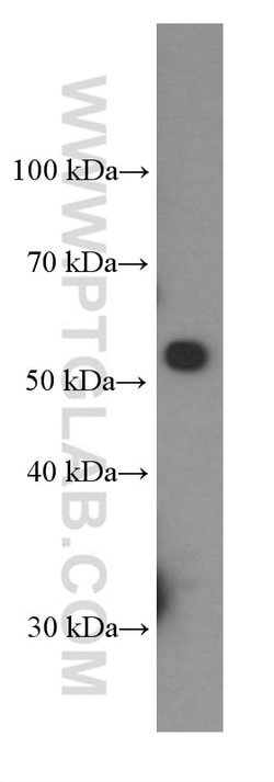 CD47 Mouse anti-Human, Clone: 1E1D8, Proteintech 150 &mu;L; Unconjugated:Antibodies,