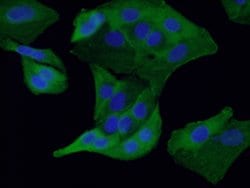 RSPO3 Mouse anti-Human, Clone: 1E4F1, Proteintech:Antibodies:Primary Antibodies
