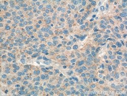 RSPO3 Mouse anti-Human, Clone: 1E4F1, Proteintech:Antibodies:Primary Antibodies