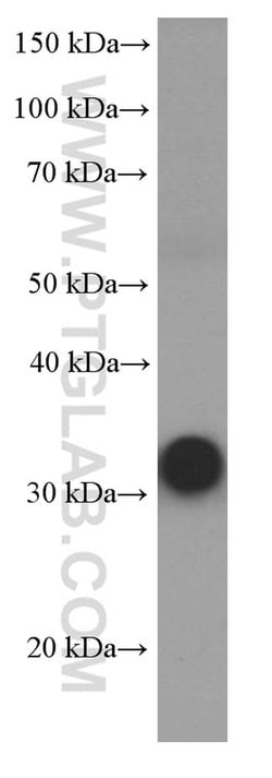 RSPO3 Mouse anti-Human, Clone: 1E4F1, Proteintech:Antibodies:Primary Antibodies