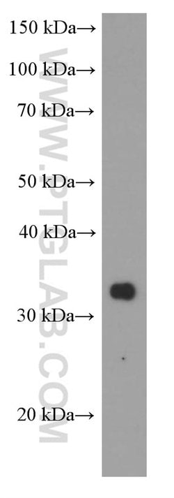 Proteintech RSPO3 Mouse anti-Human, Clone: 1E4F1, Proteintech