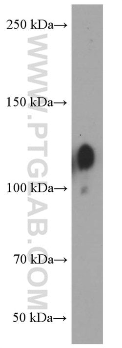 Integrin beta-1 Mouse anti-Human, Clone: 1A7C9, Proteintech 150 &mu;L;