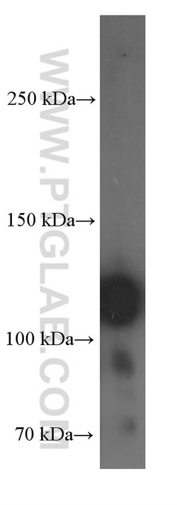 Integrin beta-1 Mouse anti-Human, Clone: 1A7C9, Proteintech 150 &mu;L;