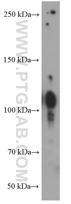 Integrin beta-1 Mouse anti-Human, Clone: 1A7C9, Proteintech 150 &mu;L;