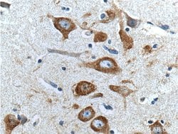 Peripherin Mouse anti-Human, Porcine, Rat, Clone: 1H10B3, Proteintech 20 &mu;L | Buy Online | Proteintech | Fisher Scientific