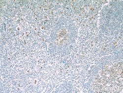 IL21R Mouse anti-Human, Clone: 1D1C2, Proteintech:Antibodies:Primary Antibodies