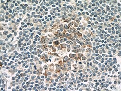 IL21R Mouse anti-Human, Clone: 1D1C2, Proteintech:Antibodies:Primary Antibodies